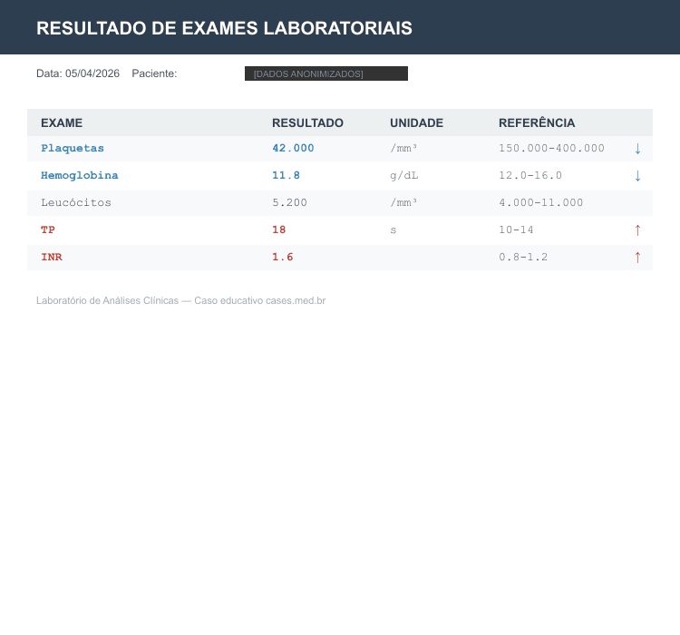 Trombocitopenia — Synthetic Lab Results