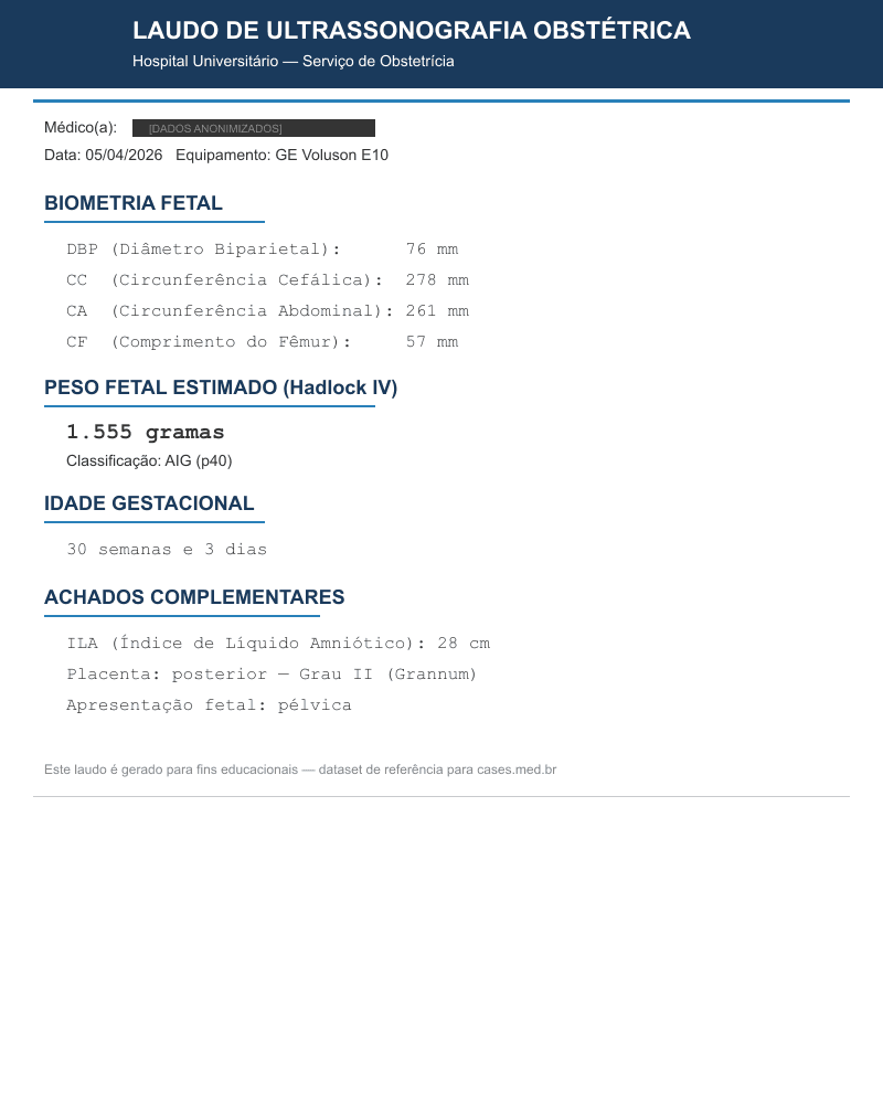 Polidrâmnio — HC18 Fetal Ultrasound