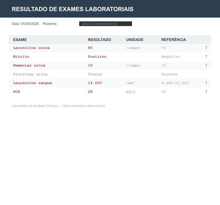 Infecção Urinária — Synthetic Lab Results