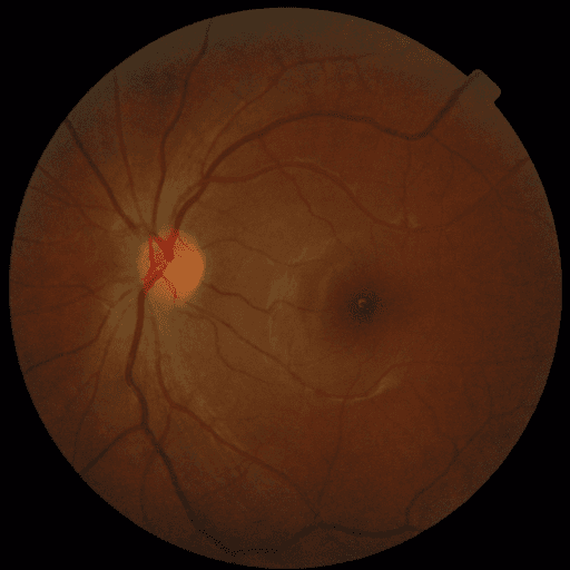 No Diabetic Retinopathy — MESSIDOR-2