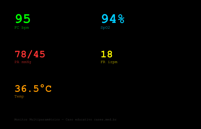 Hipotensão — Synthetic Monitor
