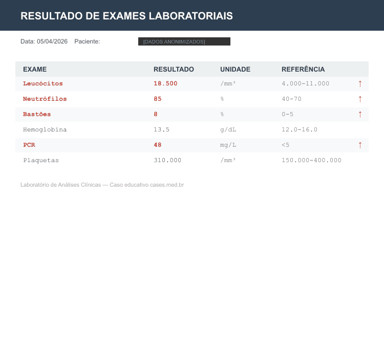 Leucocitose — Synthetic Lab Results